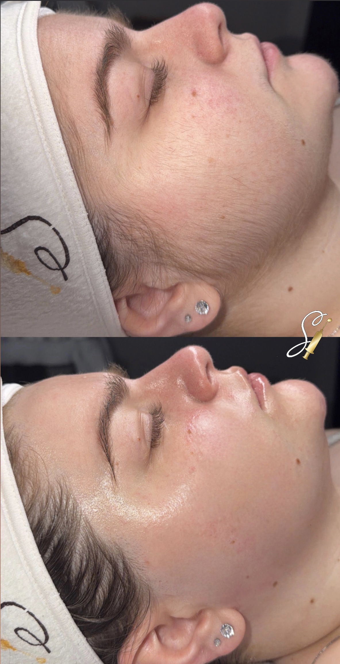 Clinical Facial Hydration & Complexion Glow