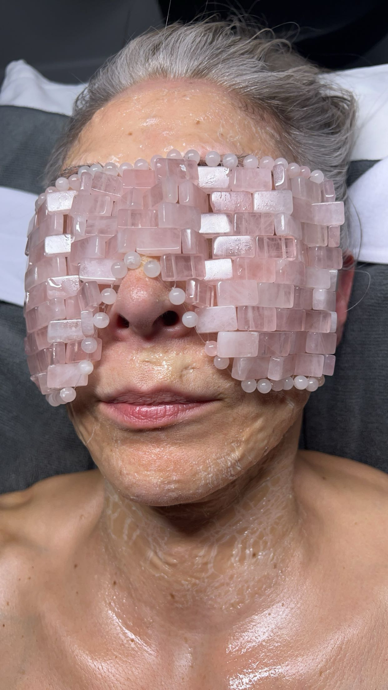 Clinical Facial Deep Extraction Result