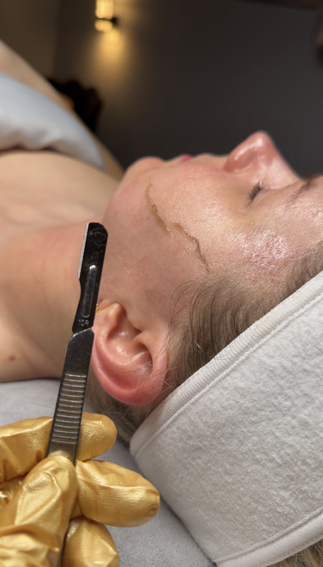 Clinical Facial Skin Texture & Acne Renewal
