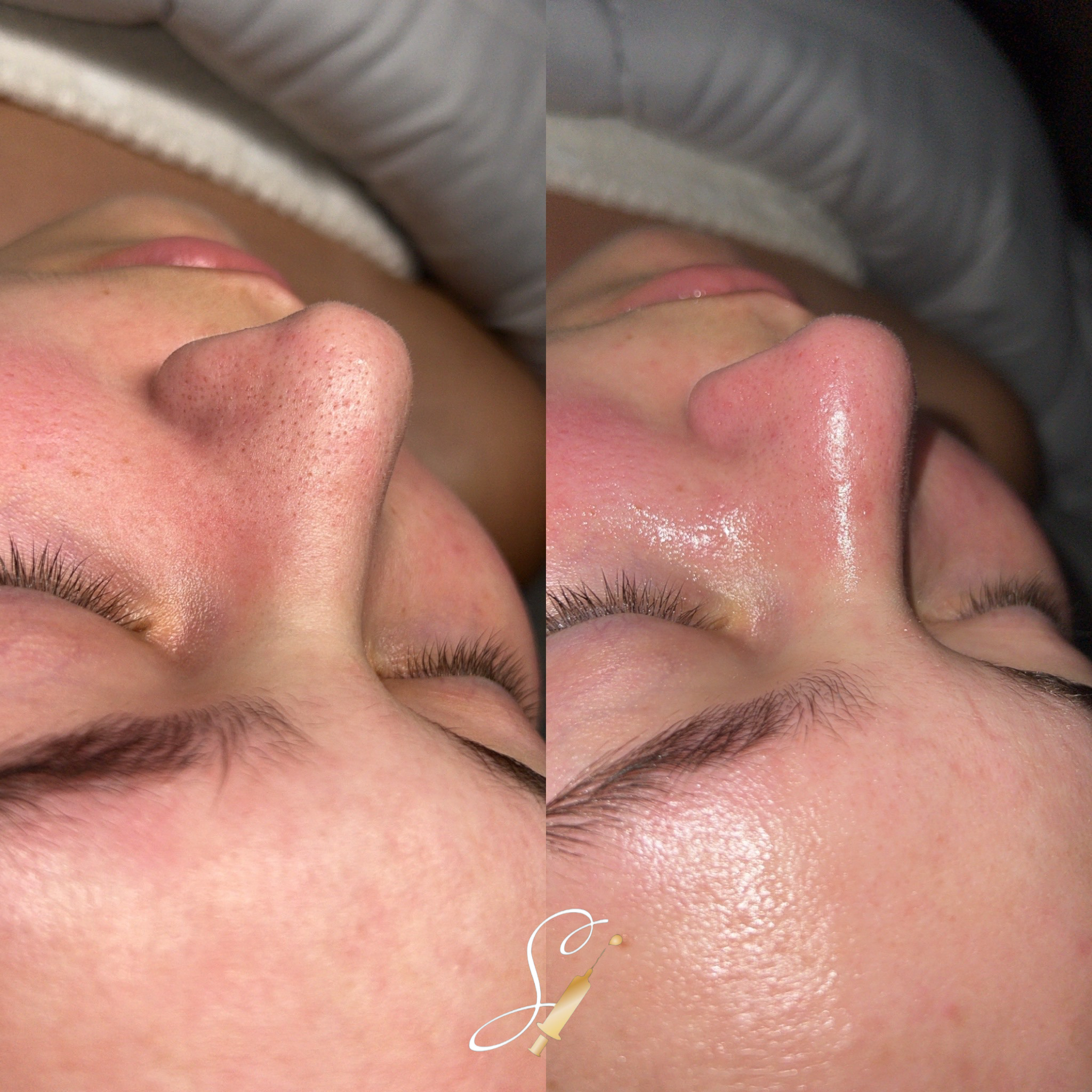 Skinsational Aesthetics Clinical Facial Treatment